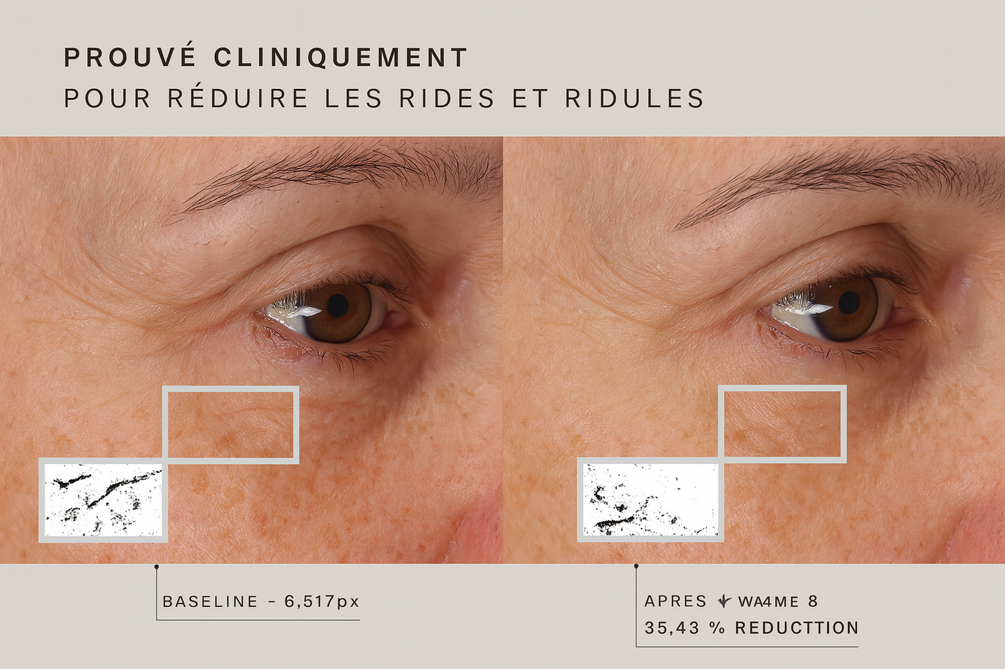 Red Light Face Mask – La lumière rouge qui transforme votre peau
